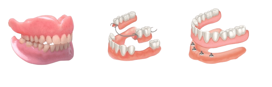 pediatric dentist Coimbatore service at Boss Dental clinic in Coimbatore