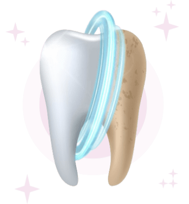 teeth cleaning Coimbatore service at Boss Dental clinic in Coimbatore