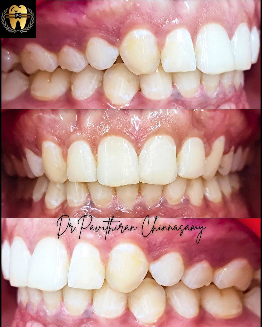 Dr.Pavithiran Chinnasamy (6) (2)